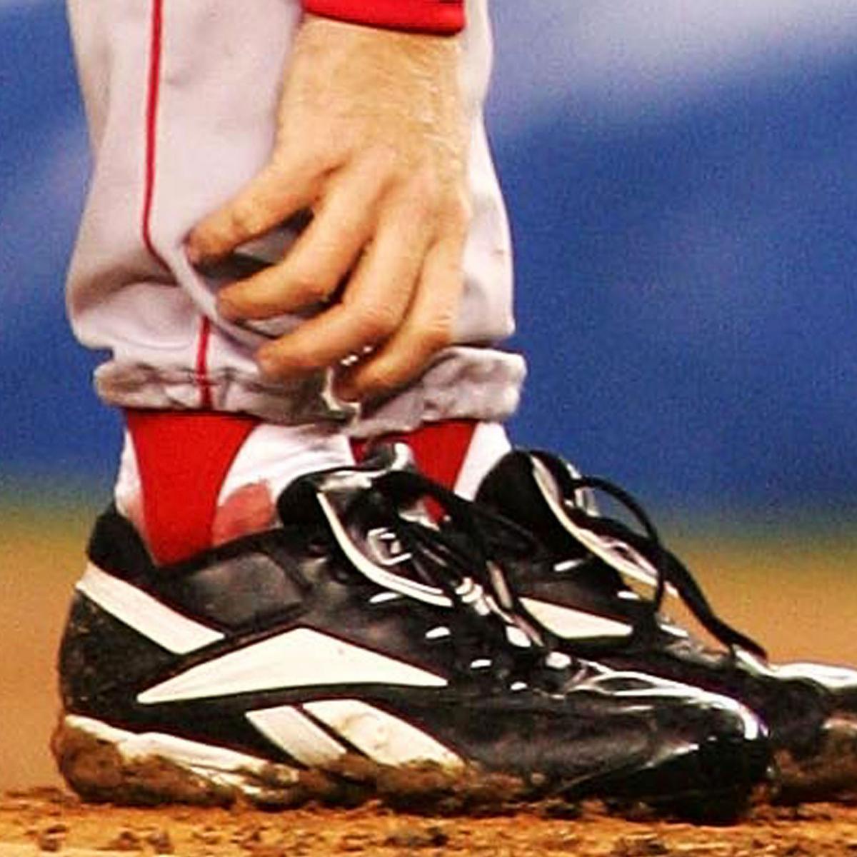 Curt Schilling Selling off 2nd Most Famous Bloody Sock at Auction