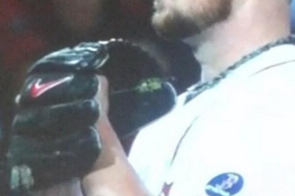 PHOTOS: Jon Lester's Glove Does Not Have a Green Substance in Game 5 of the  World Series
