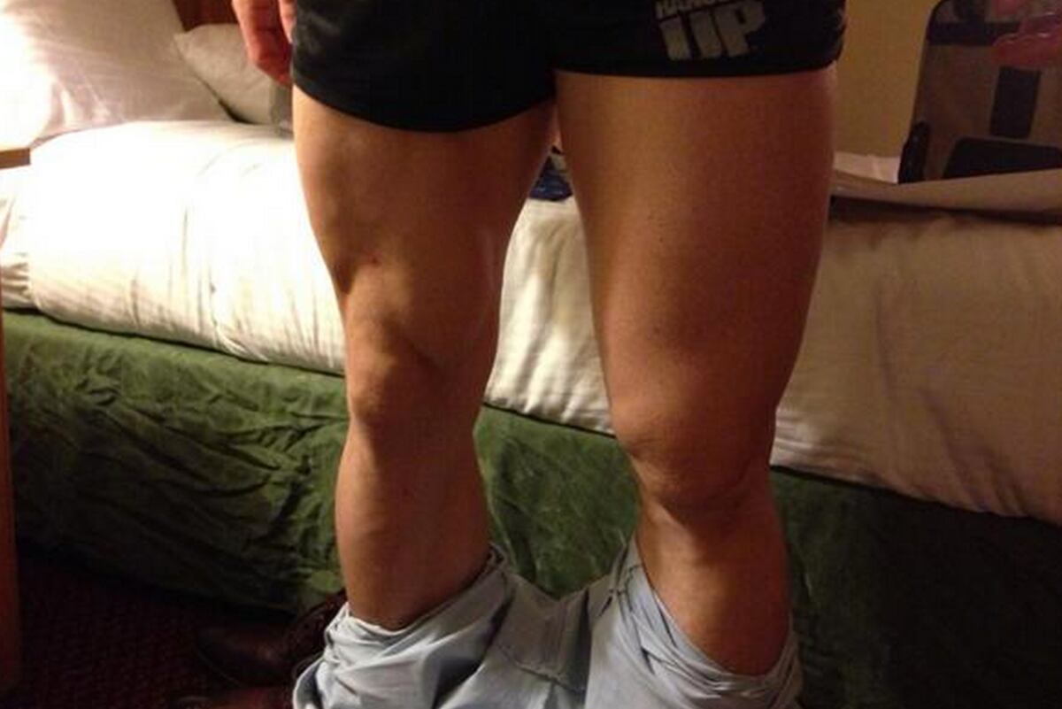 UFC Fighter Tim Kennedy Tweets Photo of Extremely Swollen Torn