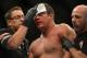 May 26, 2012; Las Vegas, NV, USA; Shane Del Rosario is treated after his fight with Stiep Miocic (not pictured) at UFC 146 at the MGM Grand Garden event center. Mandatory Credit: Ron Chenoy-USA TODAY Sports