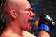 Aug 28, 2013; Indianapolis, IN, USA; Blood drips from a cut on the face of Martin Kampmann during UFC Fight Night 27 against Carlos Condit at Bankers Life Fieldhouse. Mandatory Credit: Pat Lovell-USA TODAY Sports