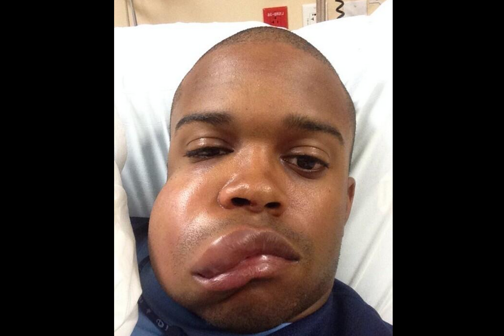Delino DeShields Jr.'s Face After Being Obliterated By Baseball