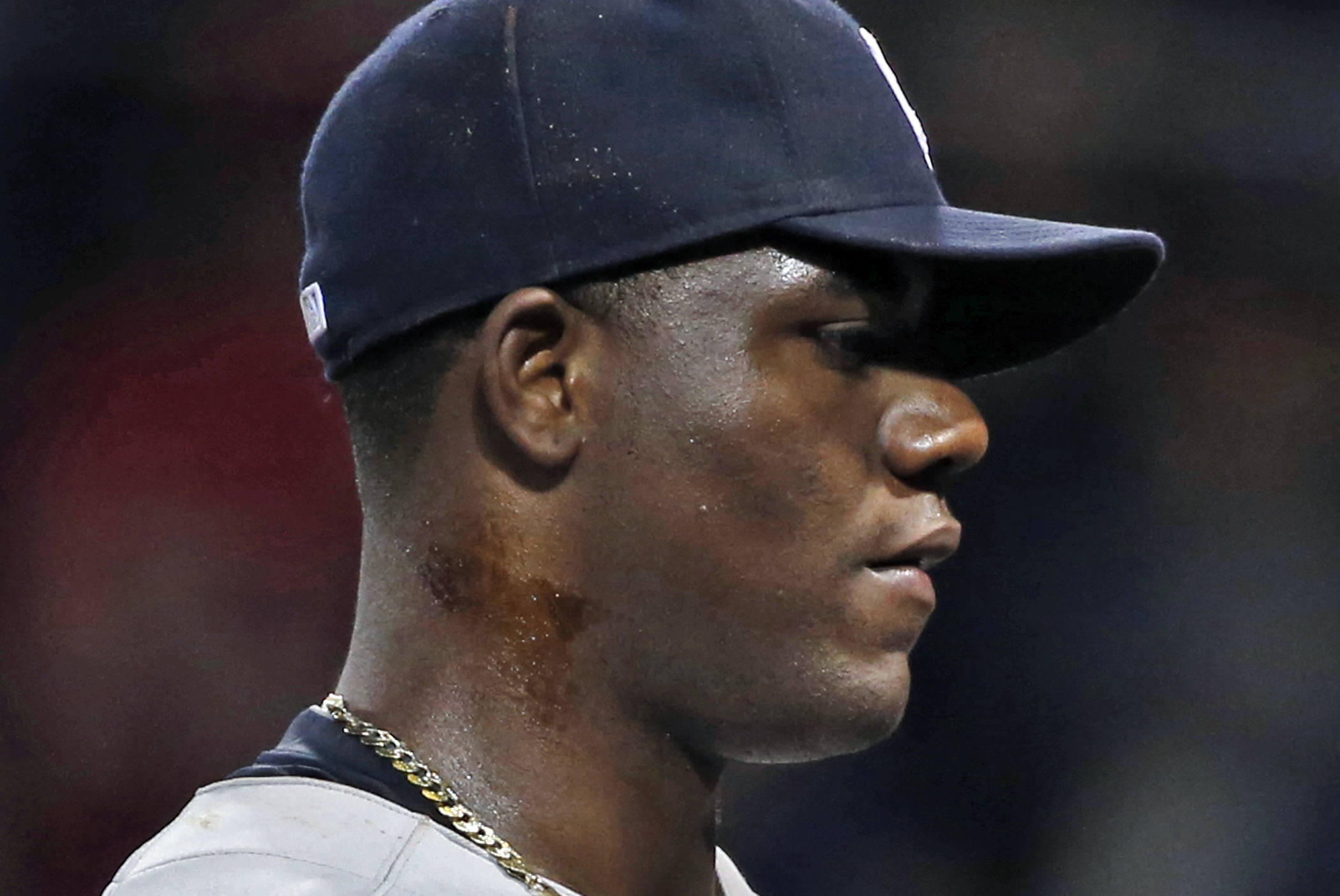 Michael Pineda is close to beginning a rehab assignment - NBC Sports