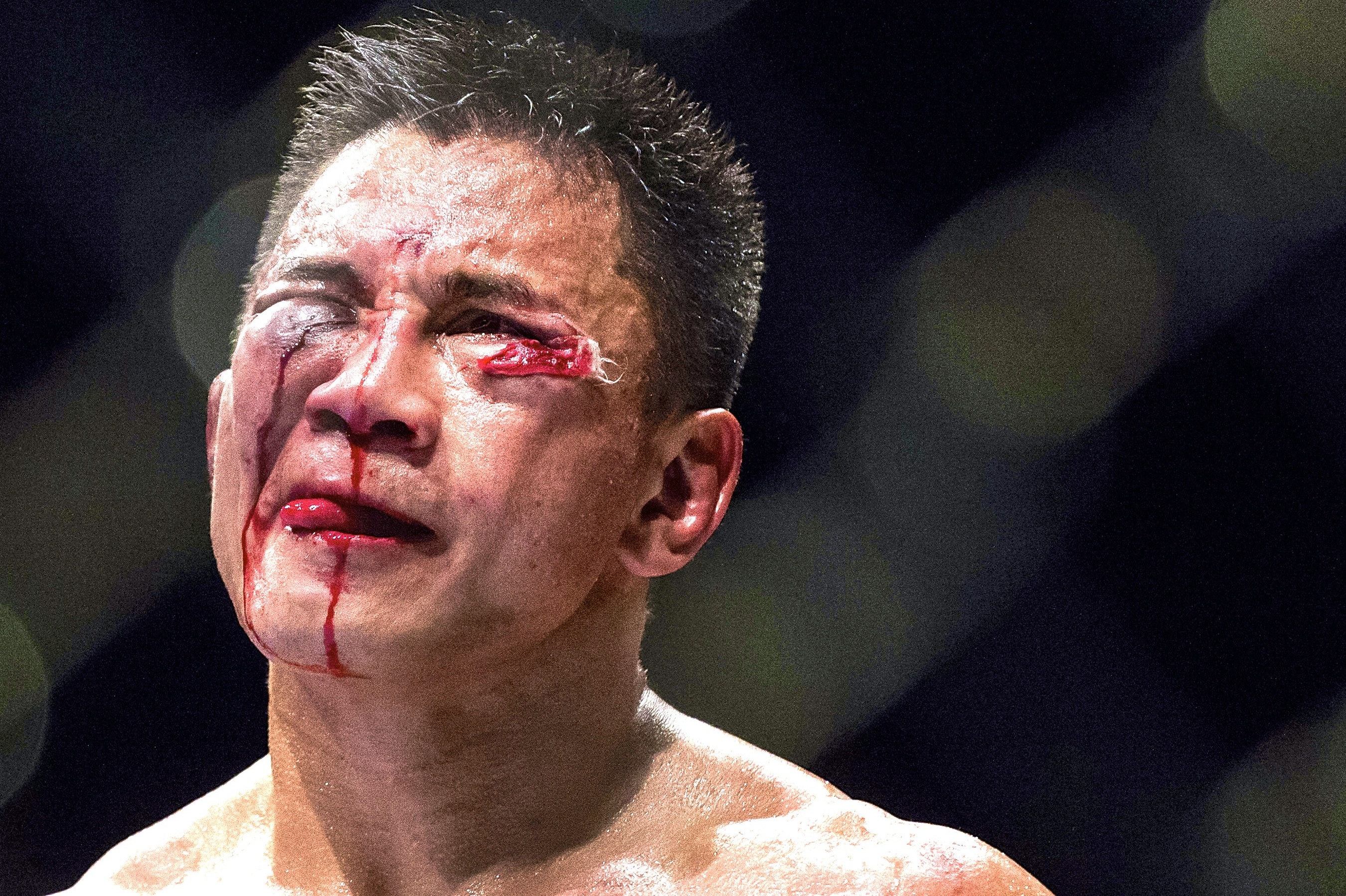 Fallout From Cung Le S Positive Drug Test Raises Questions About Ufc Testing Bleacher Report Latest News Videos And Highlights