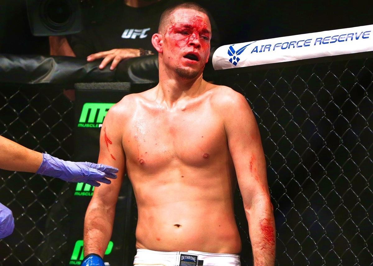 UFC on Fox 13: Rafael Dos Anjos Ends Nate Diaz's Weird Week with a Whipping | Bleacher ...