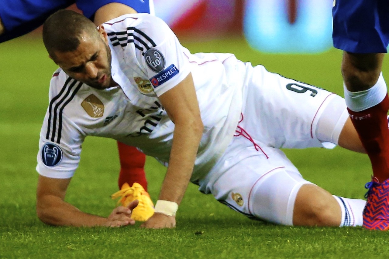 Karim Benzema's injury is minor, but he'll still miss the derby