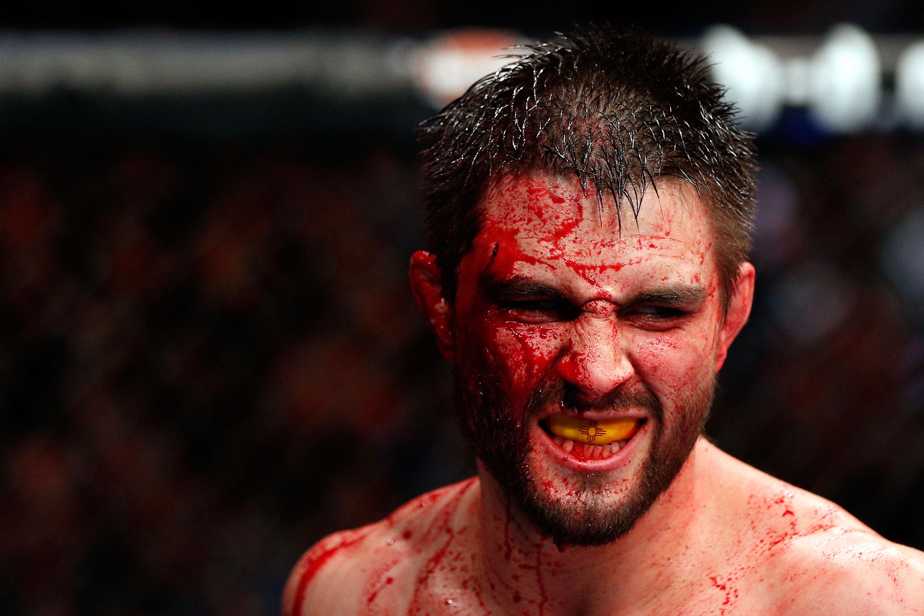 Carlos Condit, a Treasure of Fighting, Begins His Long, Slow Goodbye | Bleacher Report | Latest News, Videos and Highlights