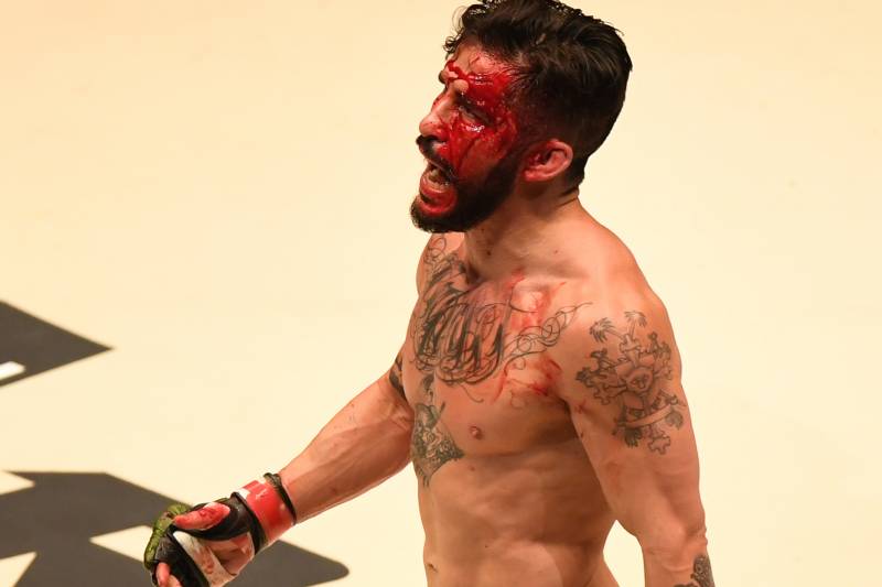 SAITAMA, JAPAN - DECEMBER 29: A bloody Ian McCall of the United States is seen in the bantam weight bout during the RIZIN Fighting World Grand-Prix 2017 2nd Round at Saitama Super Arena on December 29, 2017 in Saitama, Japan. (Photo by Etsuo Hara/Getty Images)