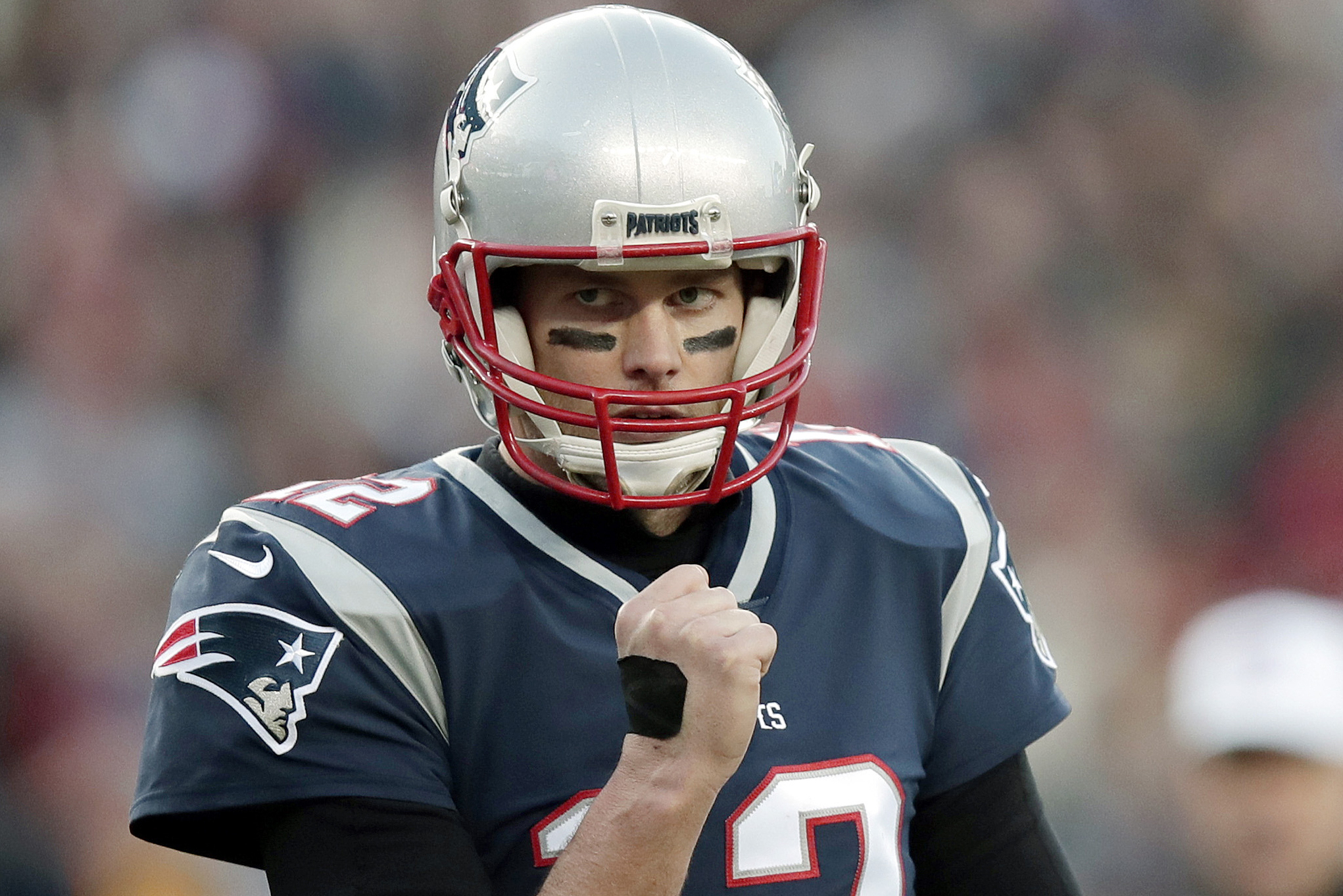 Tom Brady cuts right hand with scissors, sent home after injury