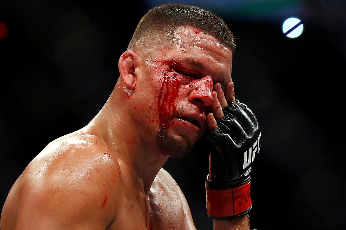 Has Nate Diaz Lost His Spot as People's Champ After ...