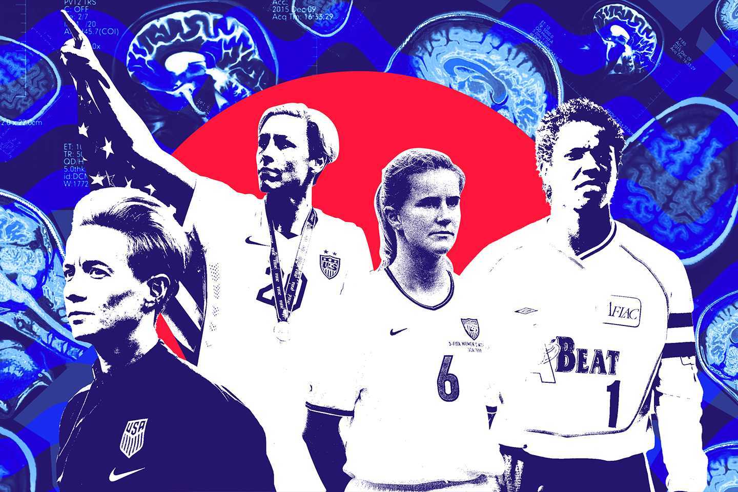 All-Female CTE Study Joined by Former Soccer Stars