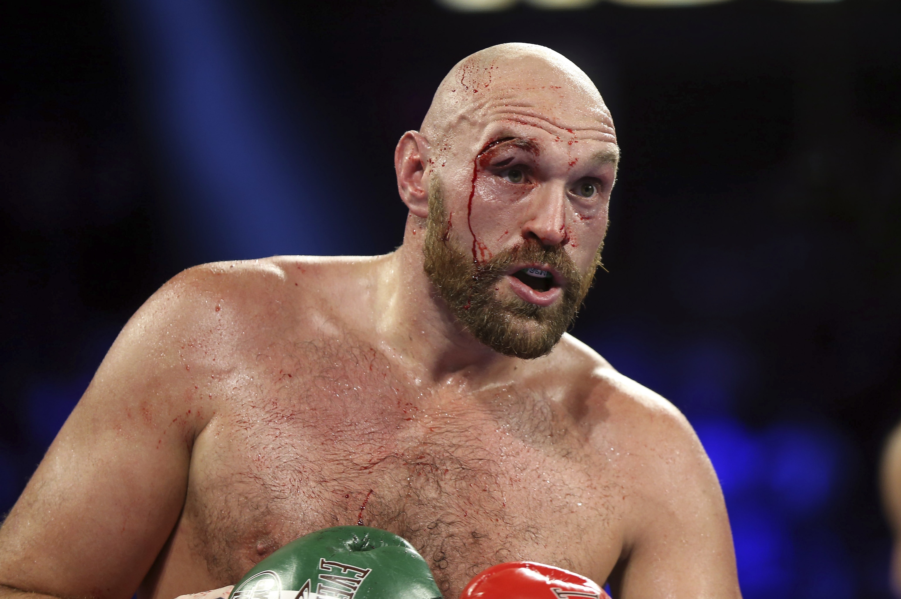 Tyson Fury Tyson Fury