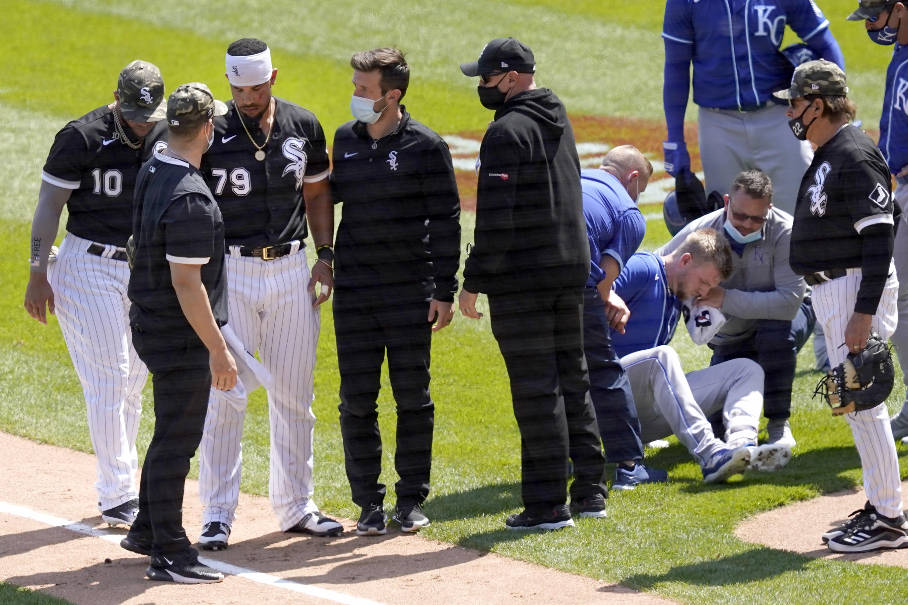 White Sox' Jose Abreu misses start with injury that 'looked like an air  hose stuck in his thumb