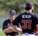 Losing Kris Medlen AND Brandon Beachy is a major blow to Atlanta.