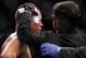 Dr. Nitin Sethi (right) examines Nate Diaz